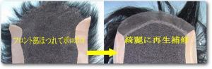 カツラの修理　画像